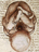 litopedion litopedion
