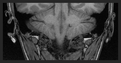 Analepsis_Presage1.jpg Analepsis_Presage1.jpg